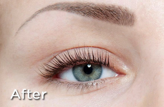 lash-lift-kidderminster-after