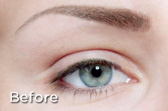 lash-lift-kidderminster