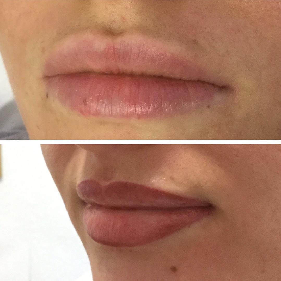 semi-permanent-lip-blush-bewdley